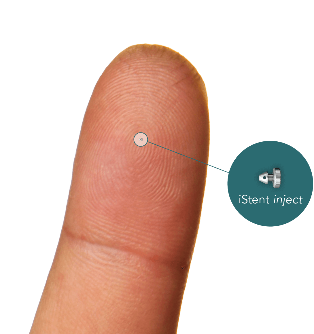 Finger with an istent inject